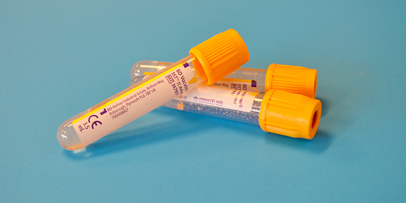 Two testtubes against a blue backdrop
